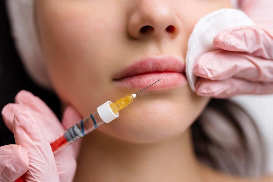 Botox For Lips